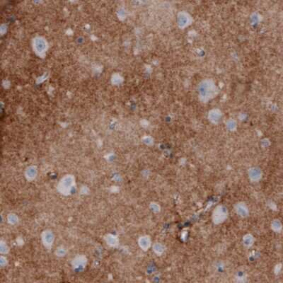Immunohistochemistry-Paraffin: Coagulation Factor III/Tissue Factor Antibody (CL3805) [NBP2-61640]
