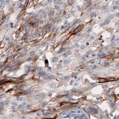 Immunohistochemistry-Paraffin: Coagulation Factor III/Tissue Factor Antibody (CL3805) [NBP2-61640]