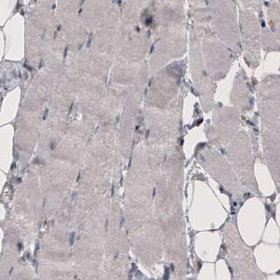 Immunohistochemistry-Paraffin: Coagulation Factor III/Tissue Factor Antibody (CL3805) [NBP2-61640]