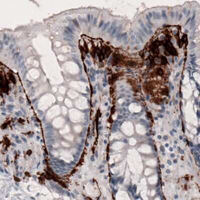 Immunohistochemistry: Coagulation Factor III/Tissue Factor Antibody (CL3807) [NBP2-61641]