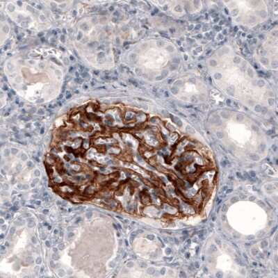 Immunohistochemistry: Coagulation Factor III/Tissue Factor Antibody (CL3807) [NBP2-61641]