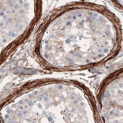 Immunohistochemistry-Paraffin: Coagulation Factor III/Tissue Factor Antibody (CL3807) [NBP2-61641]
