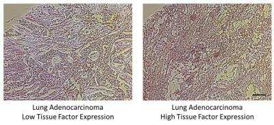 Immunohistochemistry-Paraffin: Coagulation Factor III/Tissue Factor Antibody [NBP2-15139]