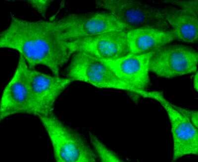 Immunocytochemistry/ Immunofluorescence: Coagulation Factor III/Tissue Factor Antibody (SN20-16) [NBP2-67731]
