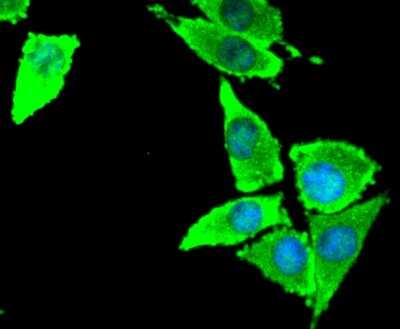 Immunocytochemistry/ Immunofluorescence: Coagulation Factor III/Tissue Factor Antibody (SN20-16) [NBP2-67731]