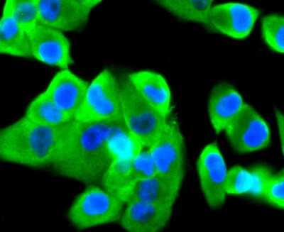 Immunocytochemistry/ Immunofluorescence: Coagulation Factor III/Tissue Factor Antibody (SN20-16) [NBP2-67731]