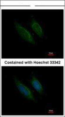 Immunocytochemistry/ Immunofluorescence: Coagulation Factor X Antibody [NBP1-33320]