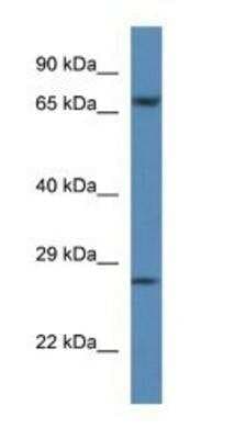 Western Blot: Coagulation Factor XI Antibody [NBP1-74234]
