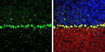 Immunohistochemistry-Frozen: Coatomer Subunit Delta Antibody (1318) [NBP2-43608]