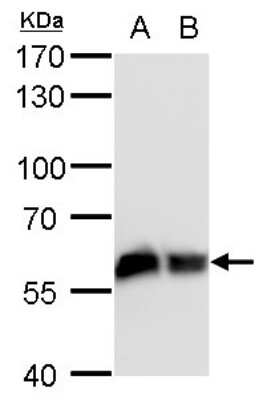 Western Blot: Coatomer Subunit Delta Antibody (1318) [NBP2-43608]