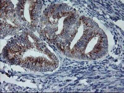 Immunohistochemistry: Coatomer Subunit Delta Antibody (OTI6A6) - Azide and BSA Free [NBP2-70203]