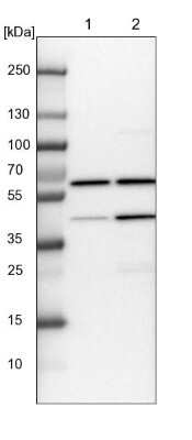 Western Blot: Coatomer Subunit Delta Antibody [NBP1-85515]