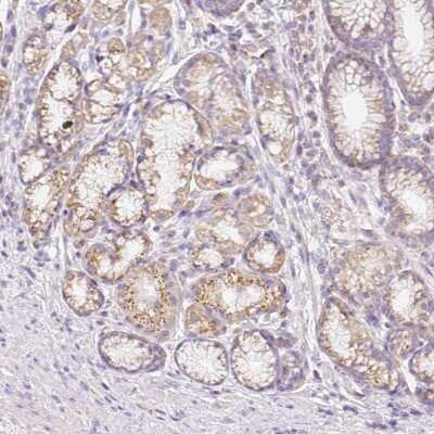 Immunohistochemistry-Paraffin: Coatomer protein complex, subunit zeta 2 Antibody [NBP2-30435]