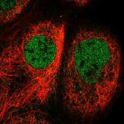 Immunocytochemistry/ Immunofluorescence: Cofilin 2 Antibody [NBP2-38544]