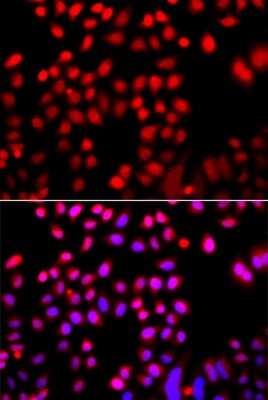 Immunocytochemistry/ Immunofluorescence: Cofilin 2 Antibody - BSA Free [NBP2-92683]