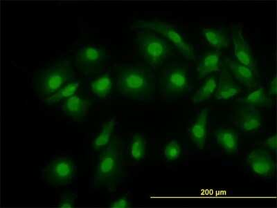 Immunocytochemistry/ Immunofluorescence: Cofilin Antibody (1A1) [H00001072-M04]