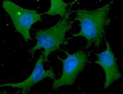 Immunocytochemistry/ Immunofluorescence: Cofilin Antibody (1C1) - BSA Free [NBP1-21044]