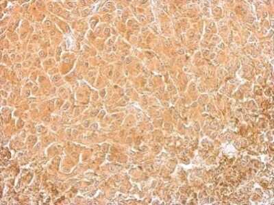 Immunohistochemistry-Paraffin: Cofilin Antibody (567) [NBP2-42828]