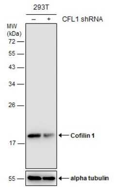 Western Blot: Cofilin Antibody (GT217) [NBP3-13520]