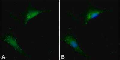 Immunocytochemistry/ Immunofluorescence: Cofilin Antibody [NB100-1900]
