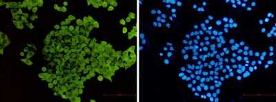 Immunocytochemistry/ Immunofluorescence: Cofilin Antibody (S06-2C0) [NBP3-15015]