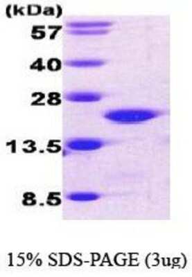 SDS-PAGE: Recombinant Human Cofilin His Protein [NBC1-18535]