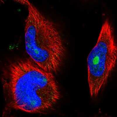 Immunocytochemistry/ Immunofluorescence: Coiled-Coil Domain Containing 149 Antibody [NBP2-30476]