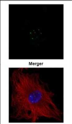 Immunocytochemistry/ Immunofluorescence: Coilin Antibody [NBP2-15939]