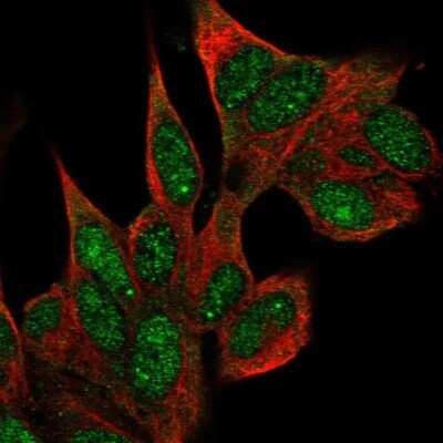 Immunocytochemistry/ Immunofluorescence: Coilin Antibody [NBP2-57887]
