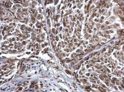 Immunohistochemistry-Paraffin: Coilin Antibody [NBP2-15939]