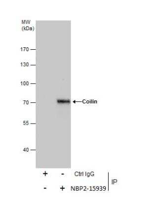 Immunoprecipitation: Coilin Antibody [NBP2-15939]