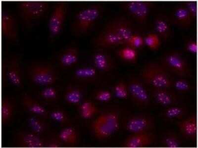 Immunocytochemistry/ Immunofluorescence: Coilin Antibody (Pdelta) - BSA Free [NB600-1275]