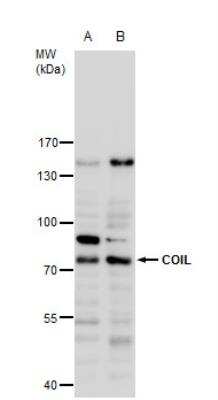 Western Blot: Coilin Antibody [NBP2-15939]