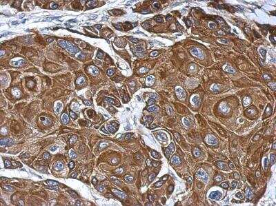 Immunohistochemistry-Paraffin: CL-P1/COLEC12 Antibody [NBP2-15944]