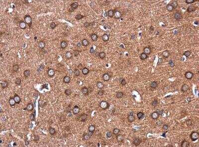 Immunohistochemistry-Paraffin: CL-P1/COLEC12 Antibody [NBP2-15944]