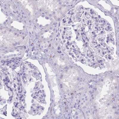 Immunohistochemistry-Paraffin: CL-P1/COLEC12 Antibody [NBP2-33508]