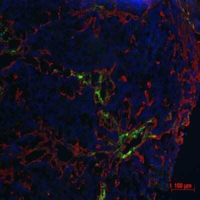 Immunohistochemical Analysis of Collagen I in Frozen Human Tumor Sections