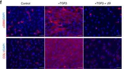Staining of TGF-beta Treated and Non-Treated Cells Using Collagen I Antibody