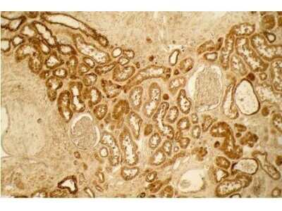Staining of Collagen I in Paraffin Embedded Human Lung Tissue