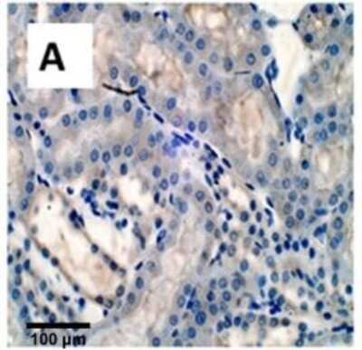 Immunohistochemical Detection of Collagen in Treated Rat Kidney