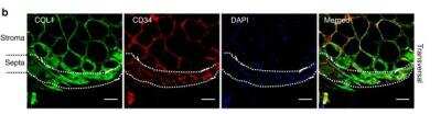 Immunohistochemical Staining of Collagen I in Human Adipose Tissue