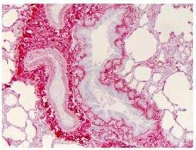 Detection of Collagen I in Paraffin Embedded Human Lung Tissue