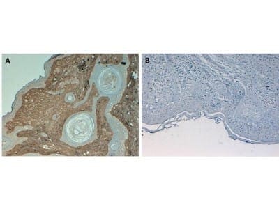 HRP Conjugated Collagen I Antibody Used in Immunohistochemistry of Paraffin Embedded Human Skin