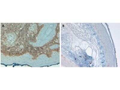 HRP Conjugated Collagen I Antibody Used in Immunohistochemistry of Paraffin Embedded Human Skin