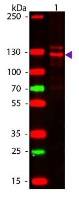 Detection of Collagen I in Western Blot