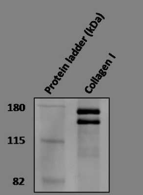 Western Blot of Collagen I in Human Trabecular Meshwork Cell Lysate