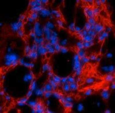 Immunohistochemistry: Collagen I alpha 1 Antibody - Azide and BSA Free [NBP1-30054]