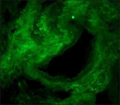 Immunohistochemistry: Collagen I alpha 1 Antibody (COL-1) [NB600-450]