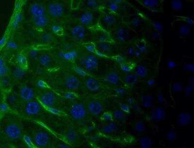 Immunohistochemistry-Paraffin: Collagen I alpha 1 Antibody (COL-1) [NB600-450]