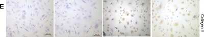 Immunohistochemistry-Paraffin: Collagen II Antibody (5B2.5) - BSA Free [NB600-844]